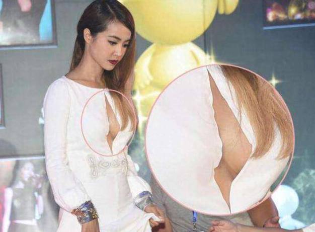 明星隆胸那些事：从遮遮掩掩到坦诚公开